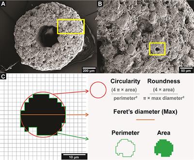 Microporosity Clustering Assessment in Calcium Phosphate Bioceramic Particles